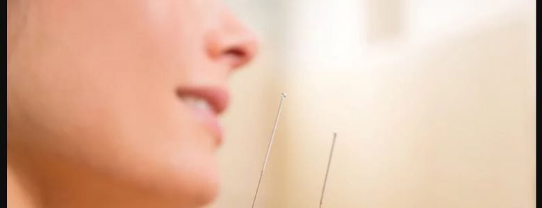 acupuncture melbourne fl
